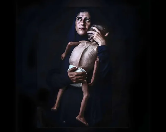 Eleven more die from malnutrition in Gaza, Hamas-run health ministry says